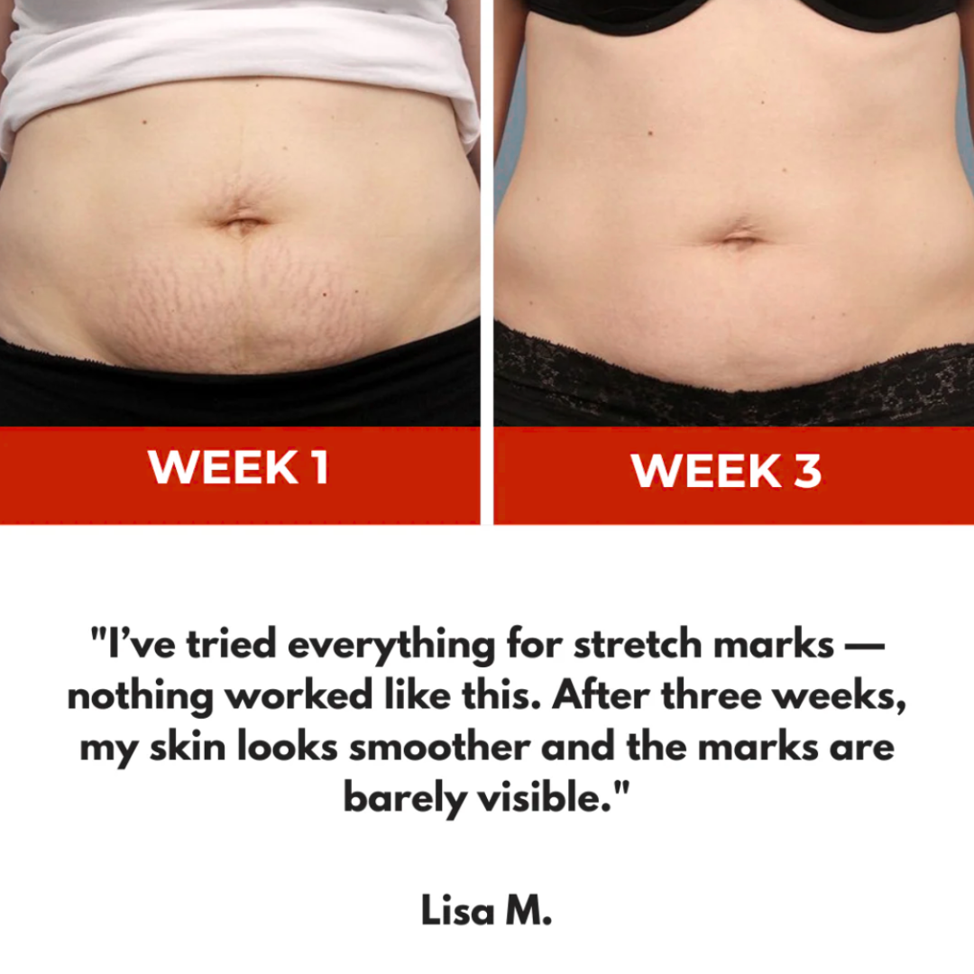 Luminous Lean™ Light Therapy Belt- Sculpt Your Body: Burn Fat, Tighten & Tone
