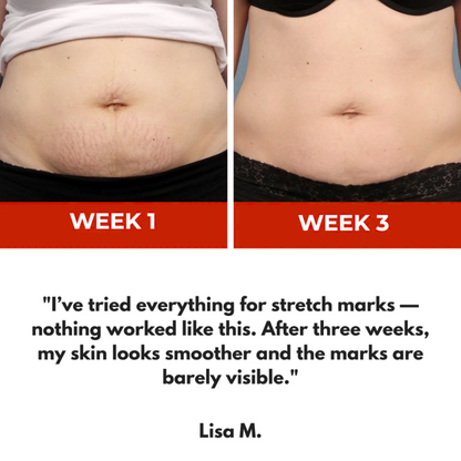Luminous Lean™ Light Therapy Belt- Sculpt Your Body: Burn Fat, Tighten & Tone