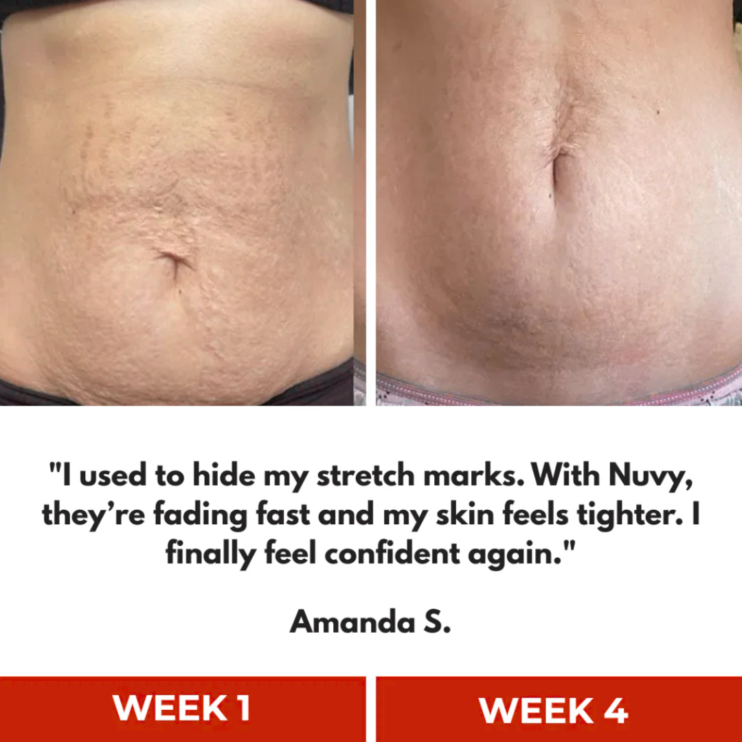 Luminous Lean™ Light Therapy Belt- Sculpt Your Body: Burn Fat, Tighten & Tone
